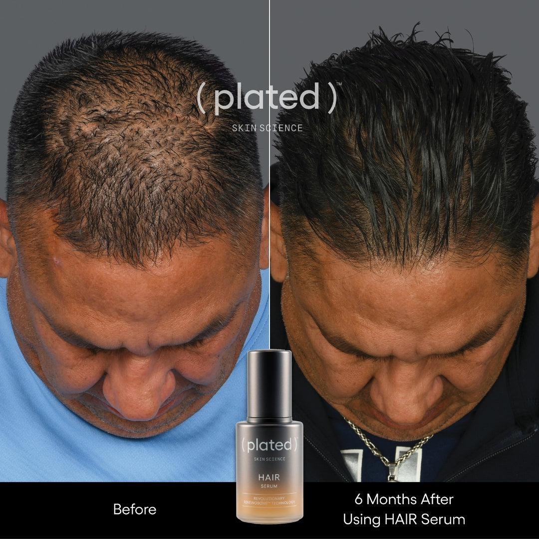 exosome Hair Serum