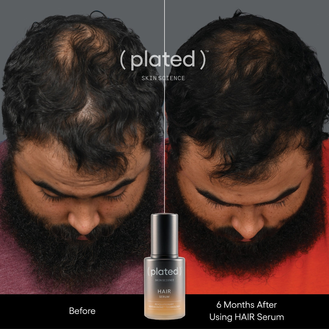 exosome Hair Serum
