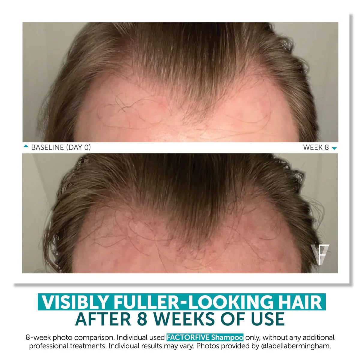 Shampoo Advanced HairCare