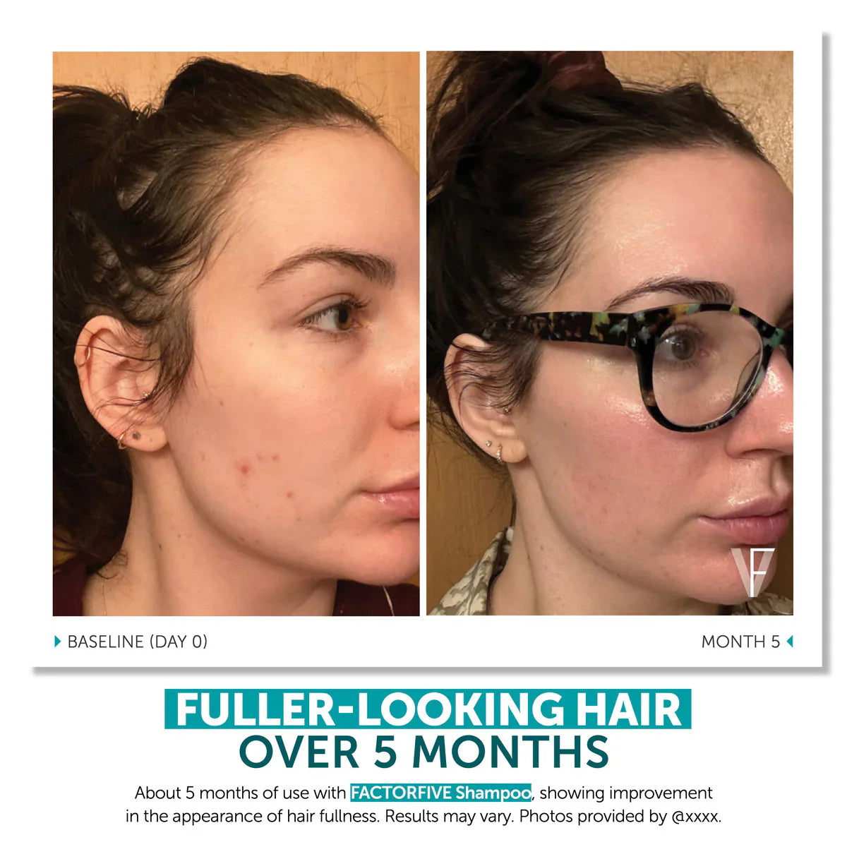 Hair Growth Duo