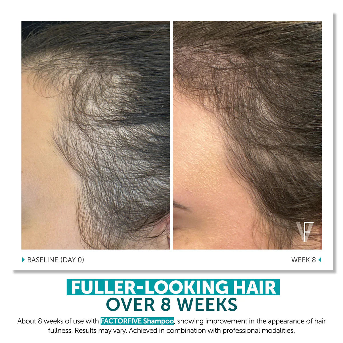 Shampoo Advanced HairCare